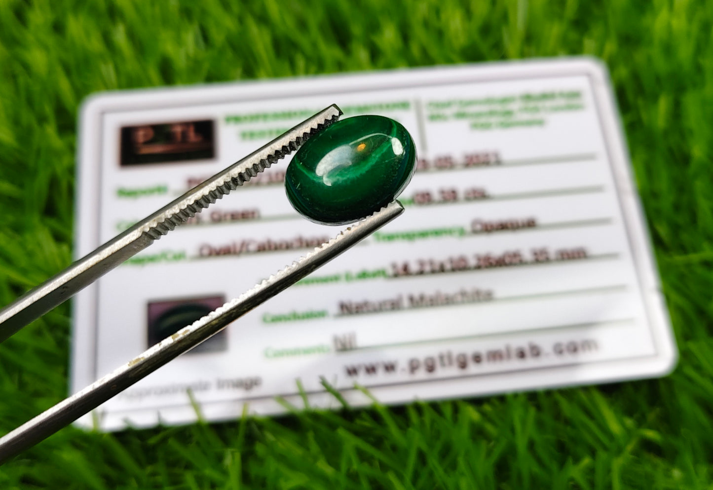 Kidney Stone With Lab certificate