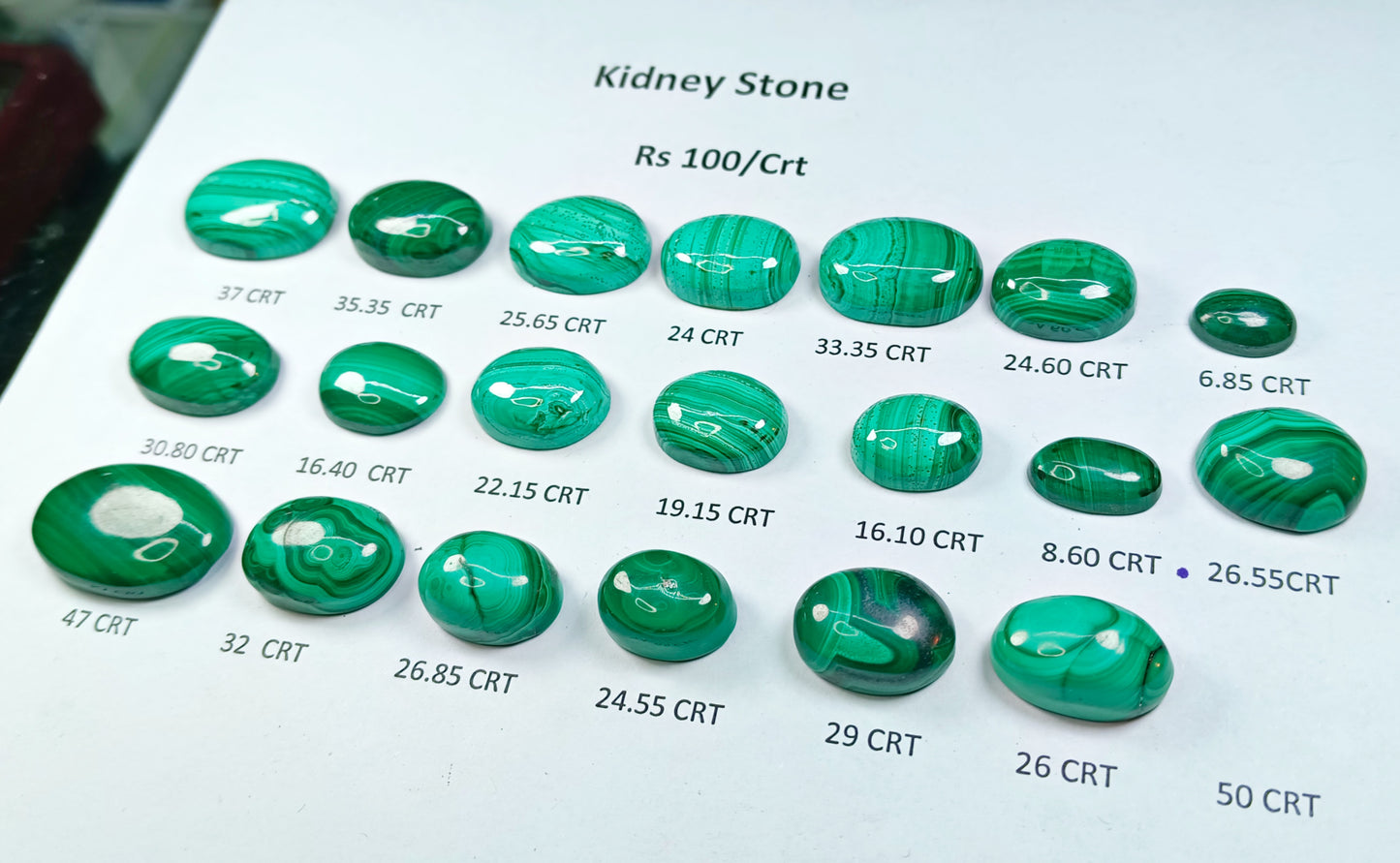 Kidney Stone