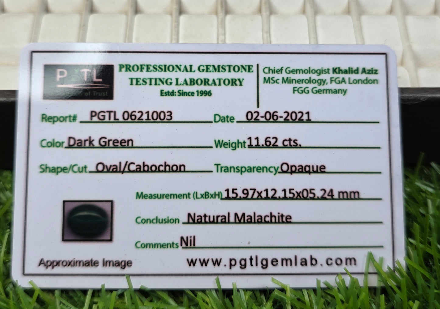 Kidney Stone With Lab Certificate