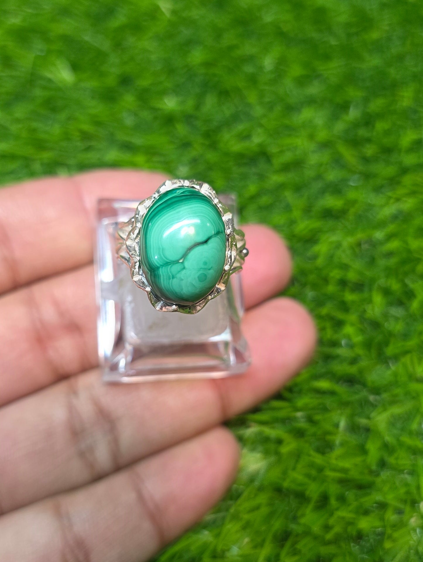 Premium Quality Kidney stone Ring