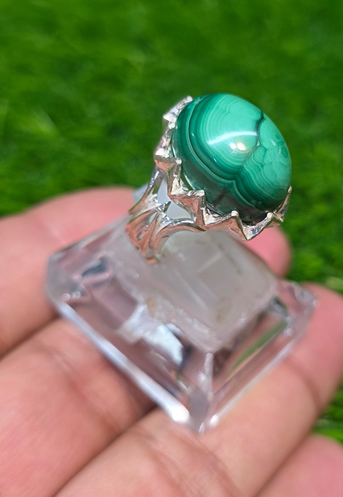 Premium Quality Kidney stone Ring