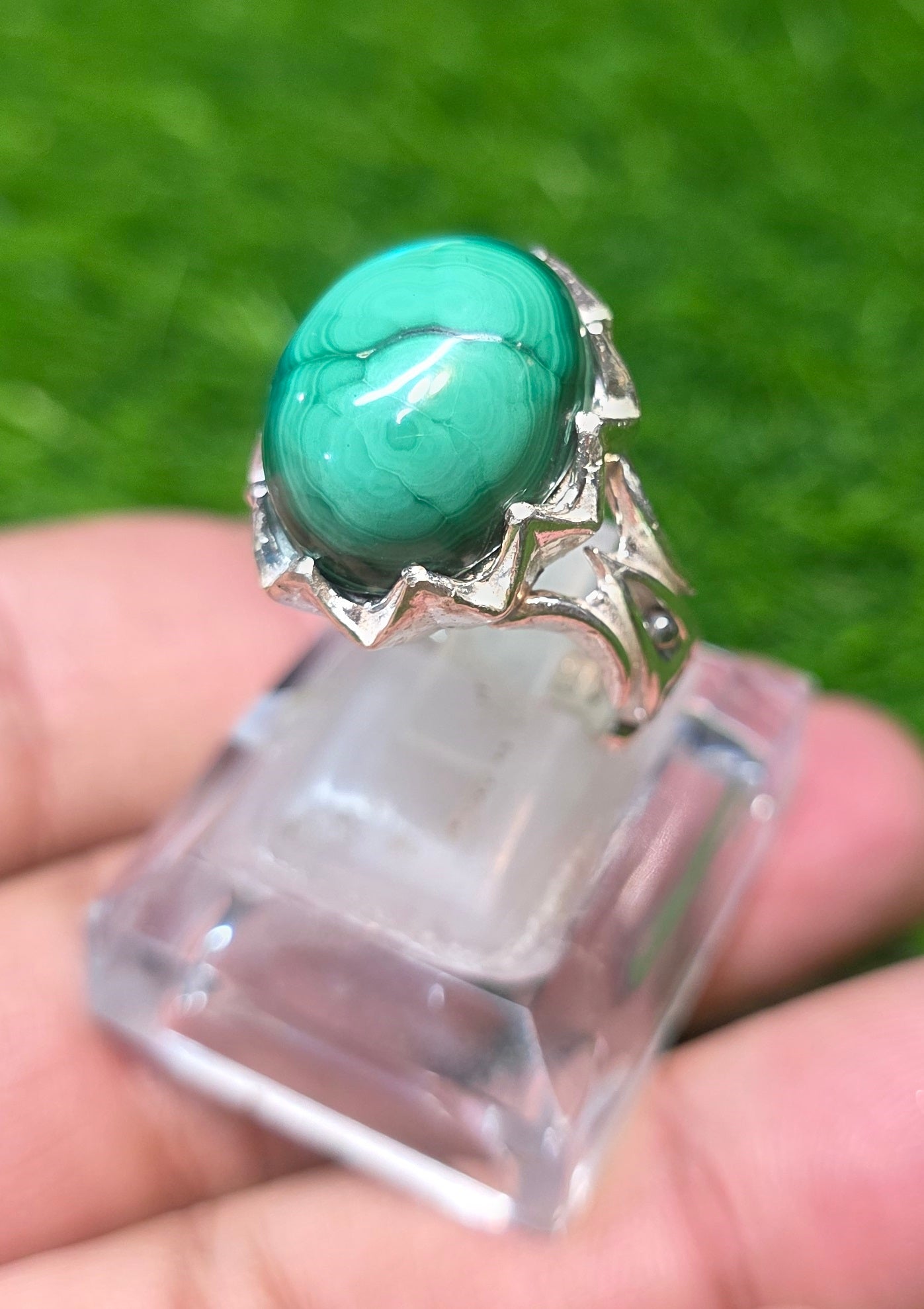 Premium Quality Kidney stone Ring