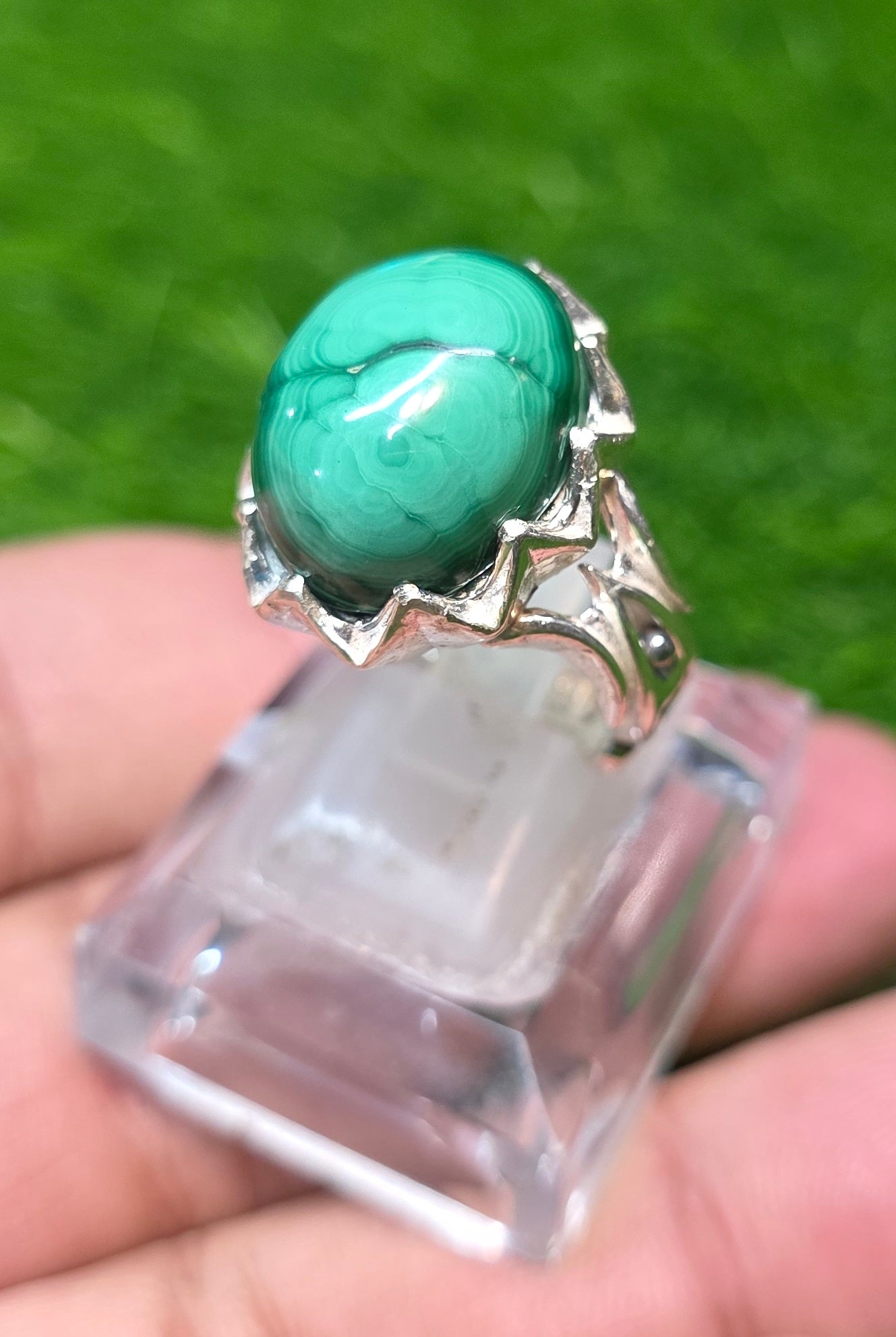 Premium Quality Kidney stone Ring