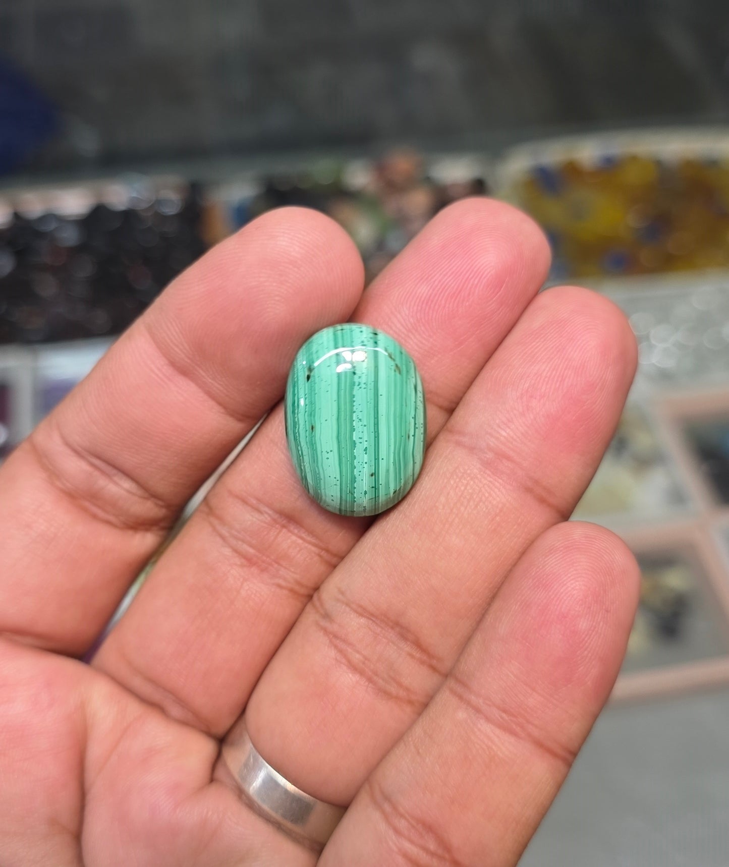 Premium Quality Kidney Stone