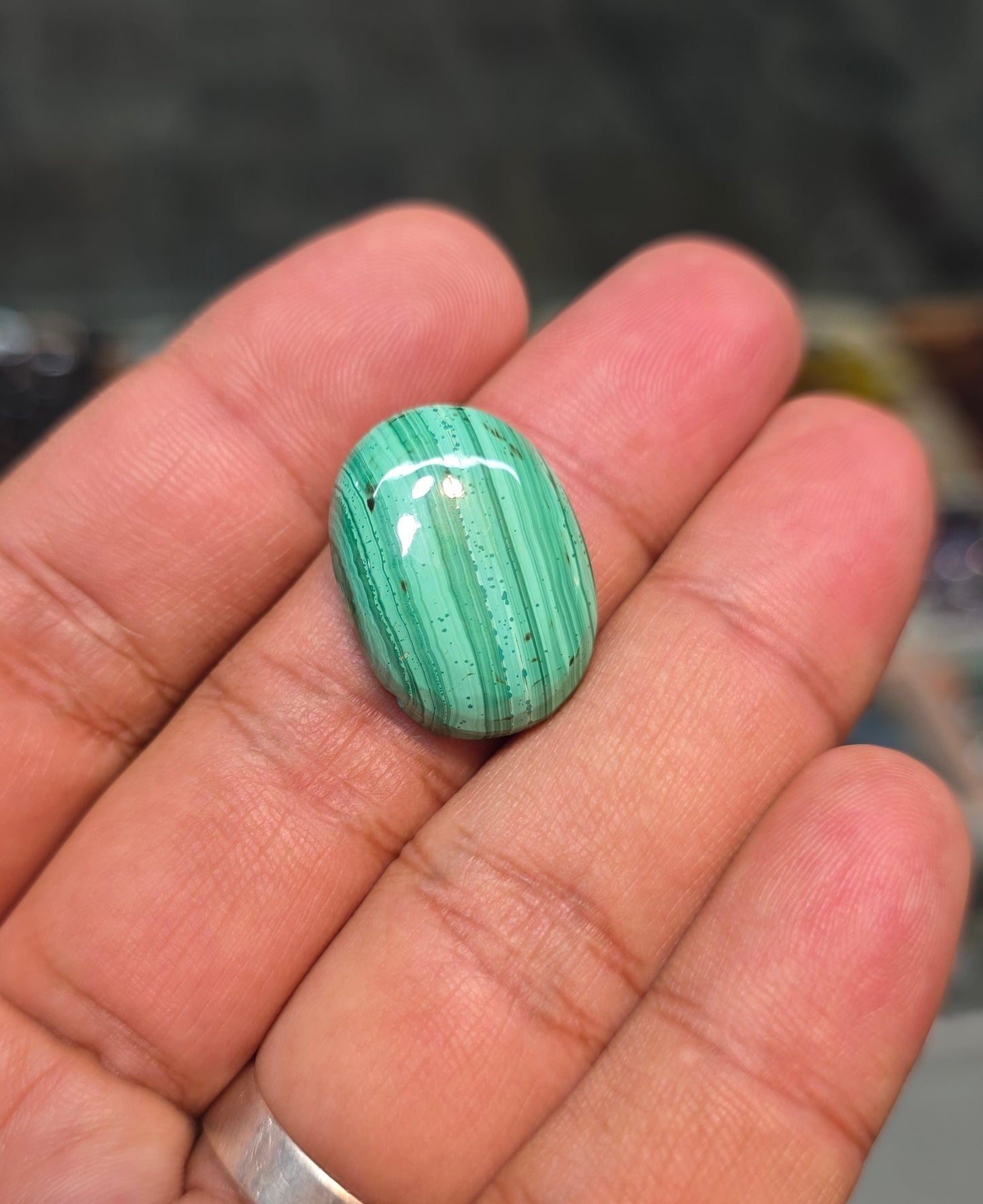 Premium Quality Kidney Stone