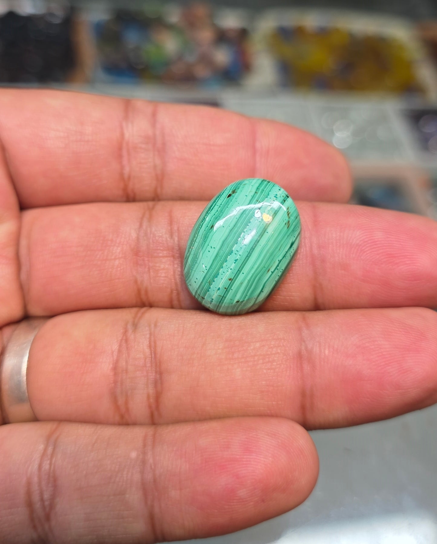 Premium Quality Kidney Stone
