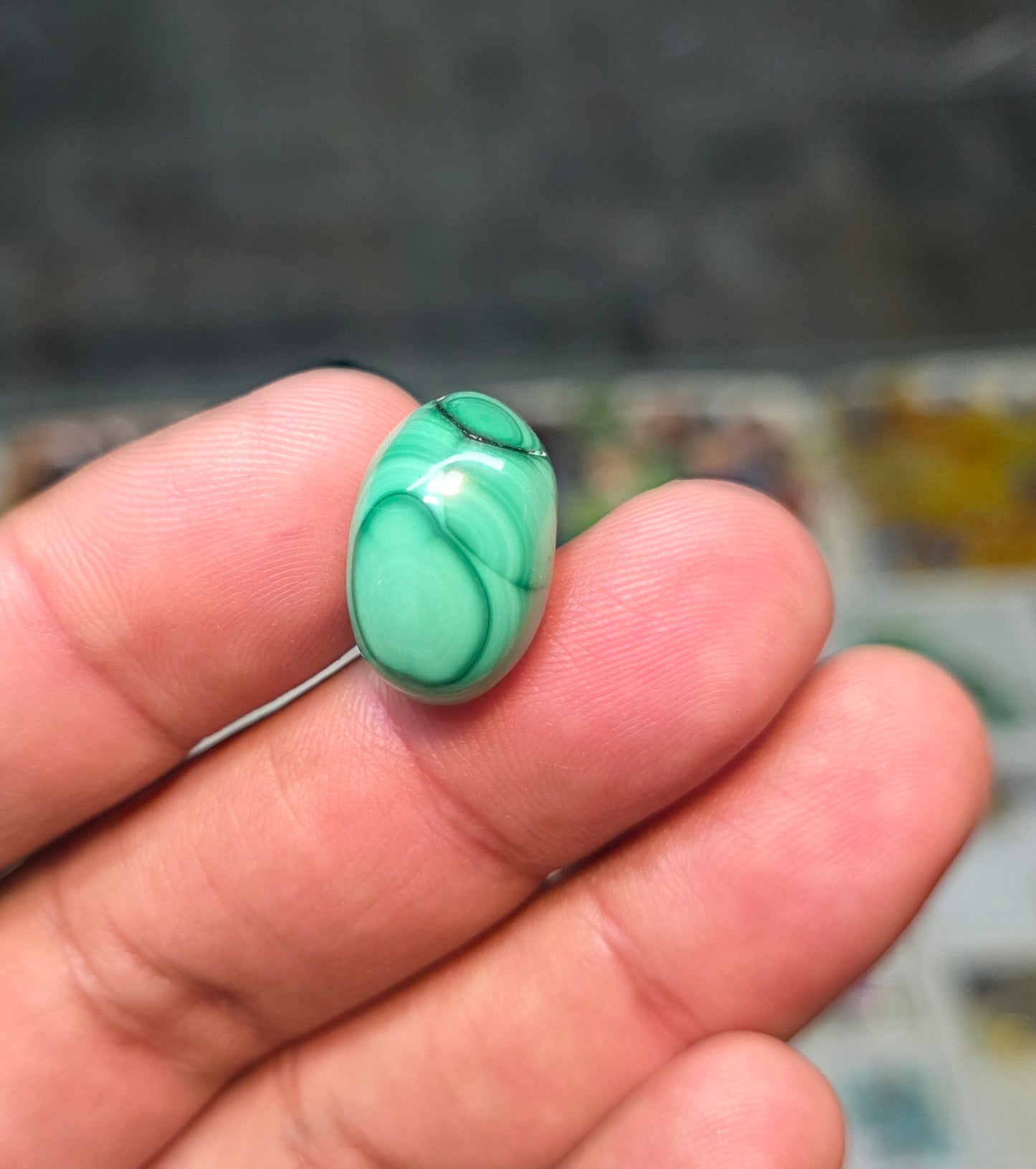Premium Quality Kidney Stone