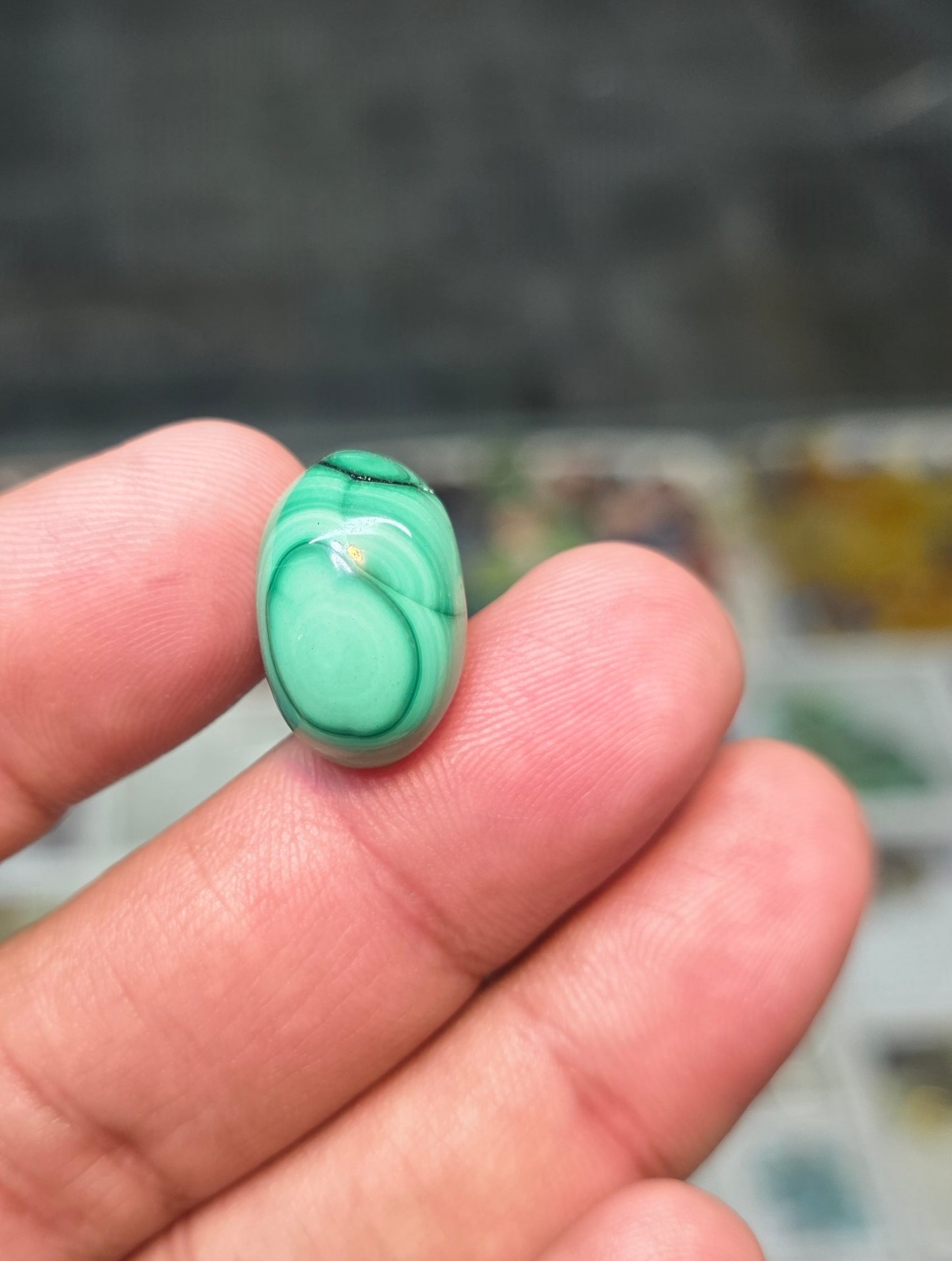Premium Quality Kidney Stone