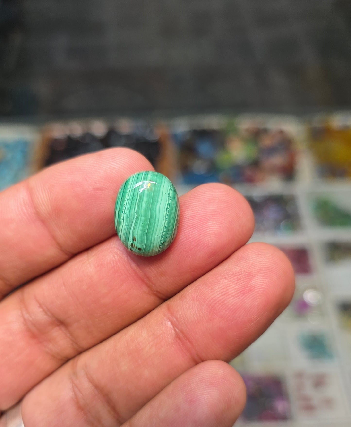 Premium Quality Kidney Stone