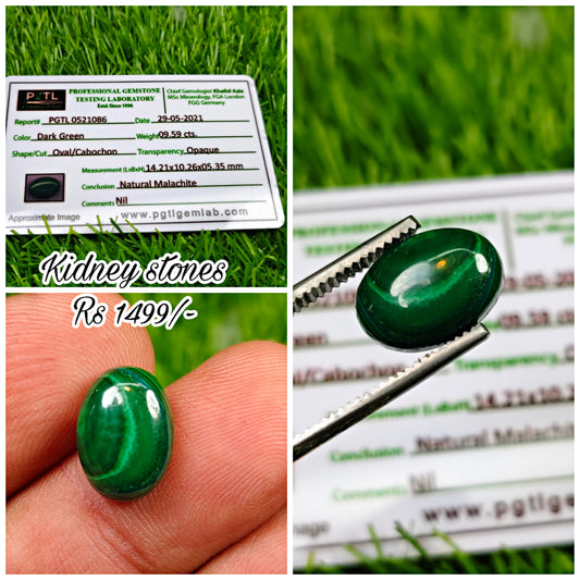 Kidney Stone With Lab certificate