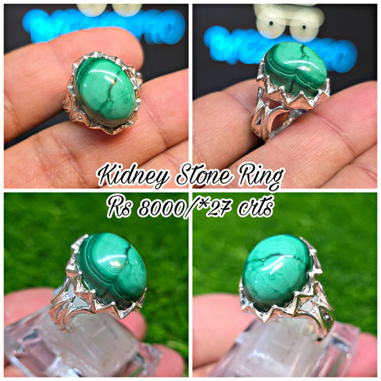 Premium Quality Kidney stone Ring